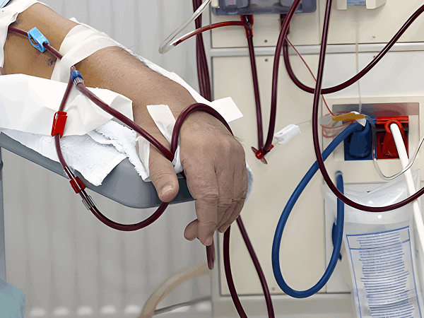 Dialysis Unit